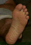 Matts_foot.JPG (12174 bytes)